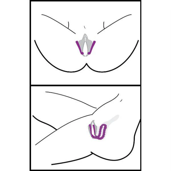 Oral Enhancing Hands Free Labia Spreader - Image 3