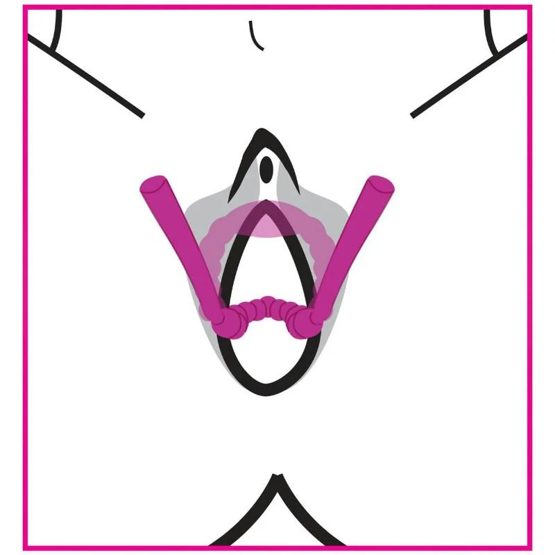 Petal Pusher Silicone Labia Spreader - Image 5